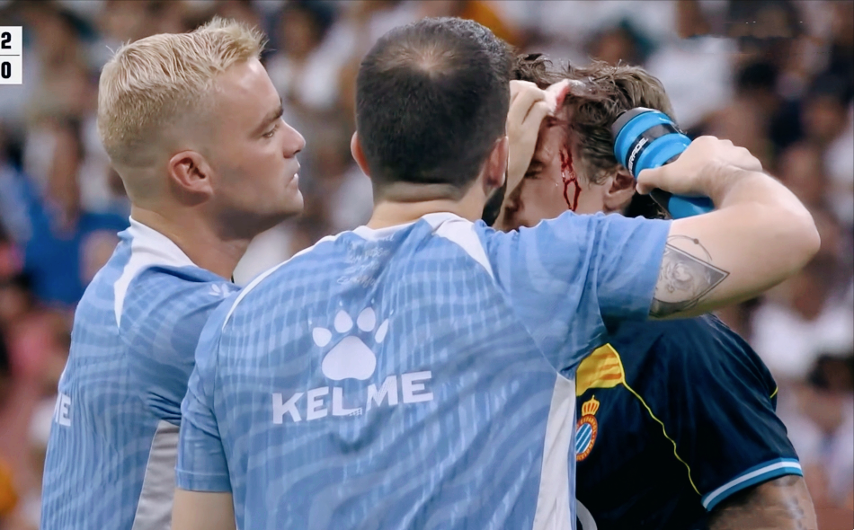 bt, 面对大好的, DR